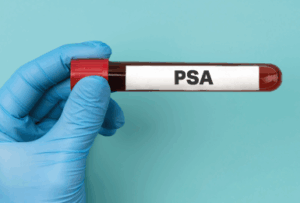 Novembro Azul - O PSA.